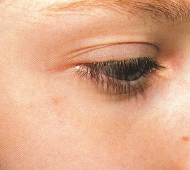 Woman after skin treatment