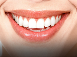 Teddington Teeth Whitening