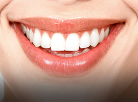 Teeth whitening treatment