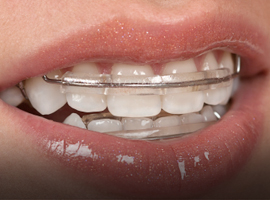 Tooth repair treatment
